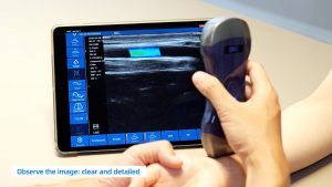 Viatom Pocket Ultrasound Operation Demo